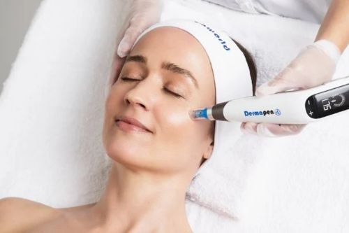 Micro-Needling